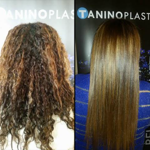 La taninoplastie Clearance